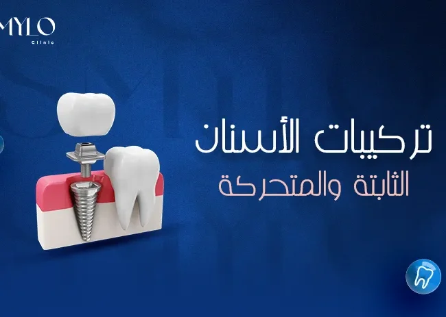 تركيبات الأسنان الثابتة والمتحركة
