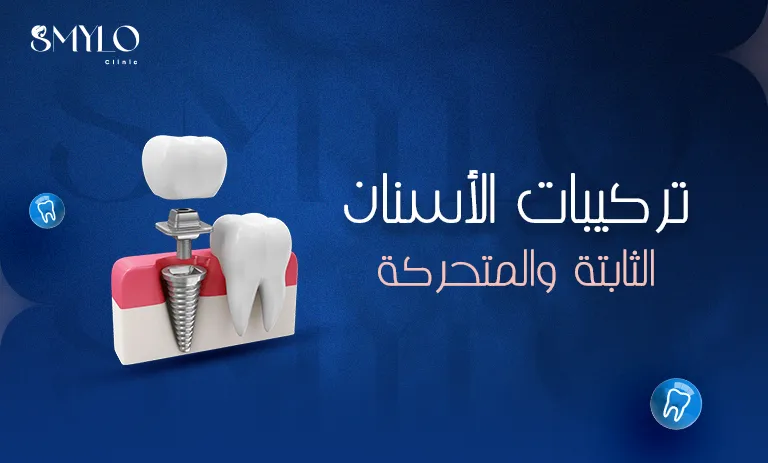 تركيبات الأسنان الثابتة والمتحركة