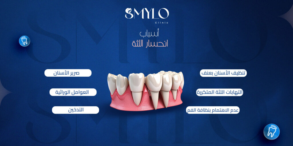 أسباب انحسار اللثة