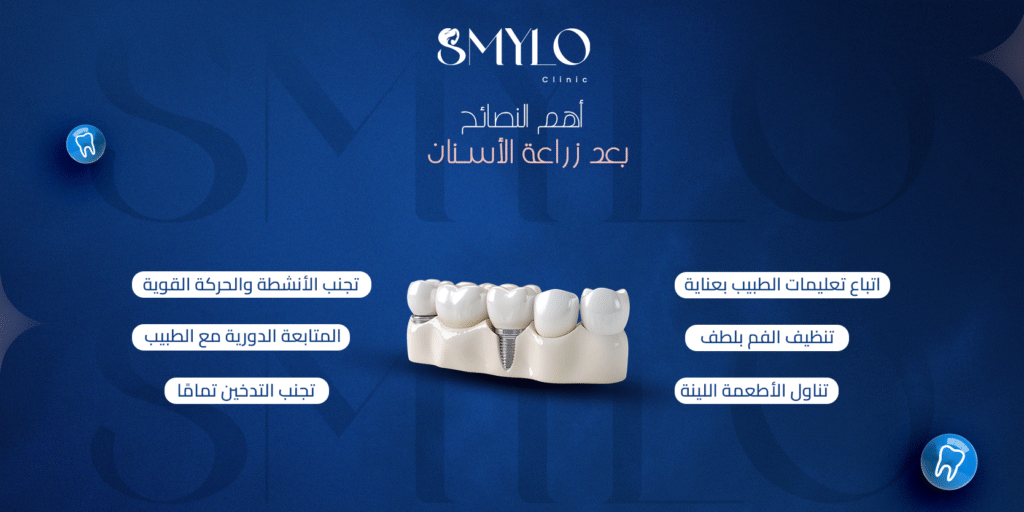 أهم النصائح بعد زراعة الأسنان