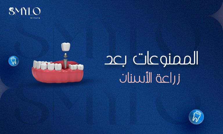 الممنوعات بعد زراعة الأسنان