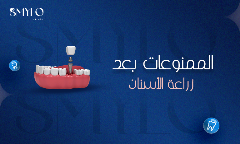 الممنوعات بعد زراعة الأسنان