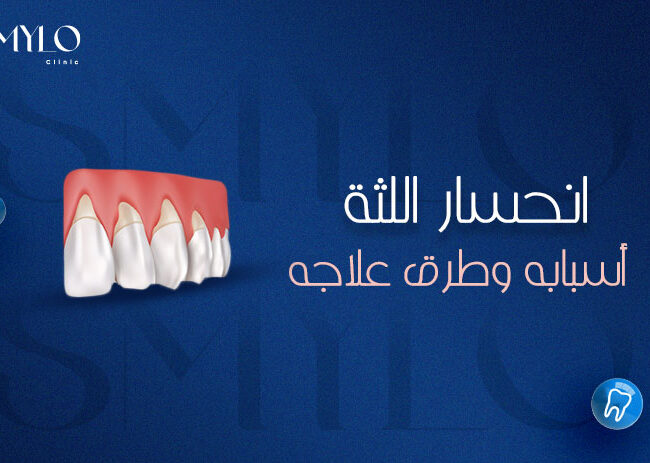 انحسار اللثة