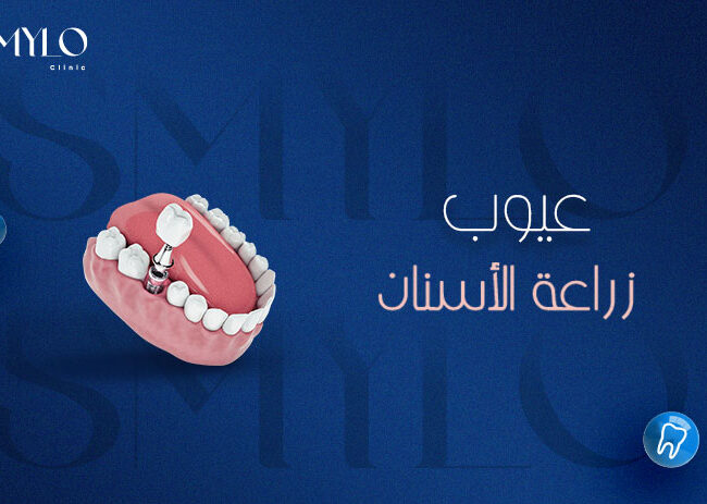 عيوب زراعة الاسنان​