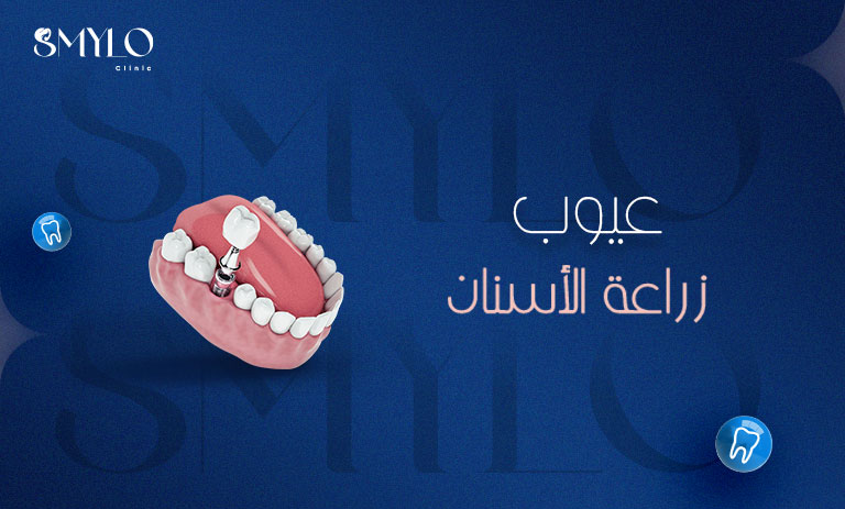 عيوب زراعة الاسنان​