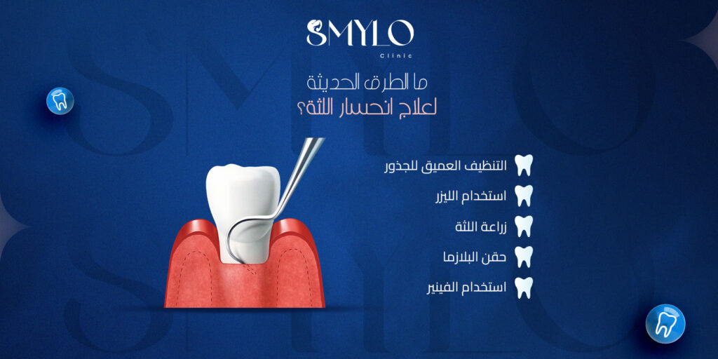 ما الطرق الحديثة لعلاج انحسار اللثة؟