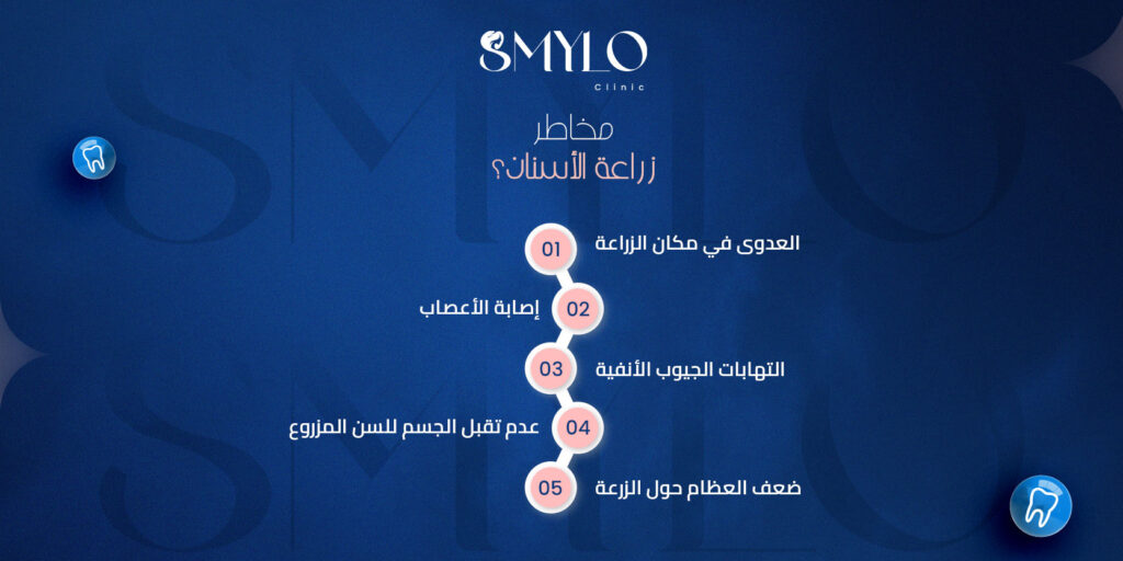 مخاطر زراعة الأسنان