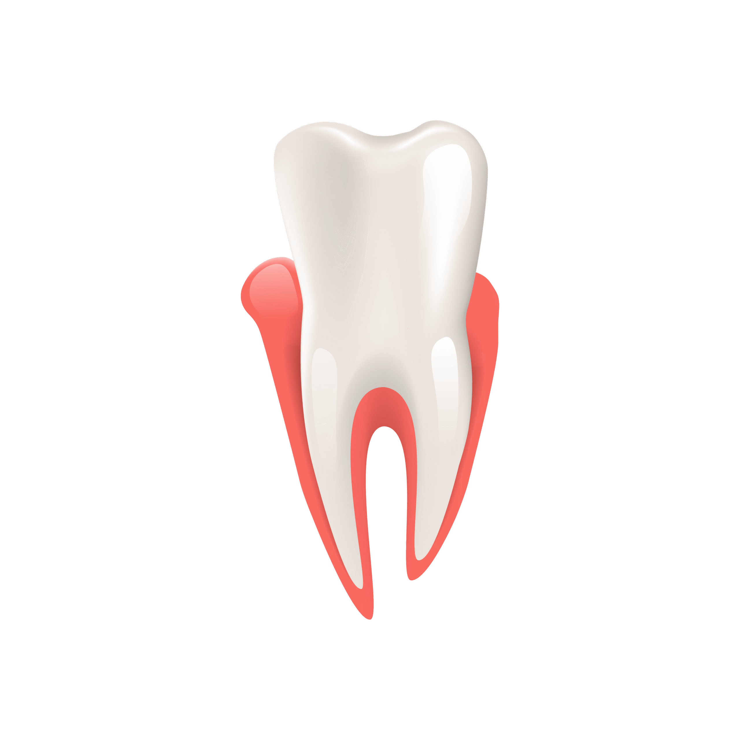 gum overgrowth surgery