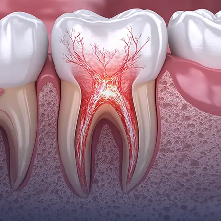 Tooth Nerve