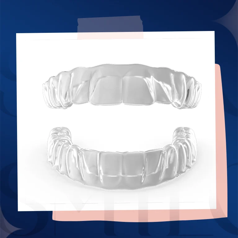 clear aligners invisalign