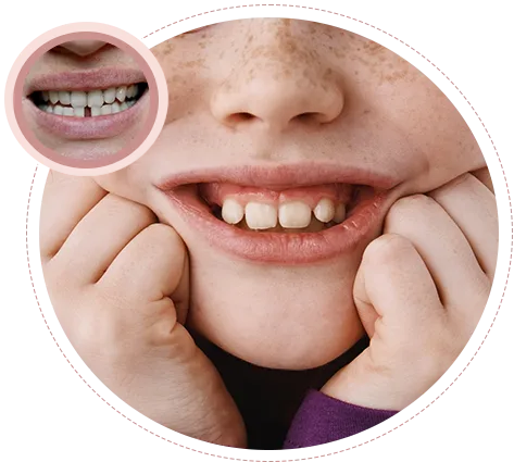 orthodontics importance