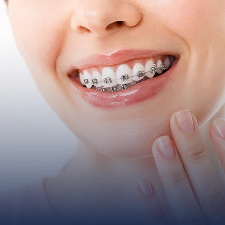 orthodontics