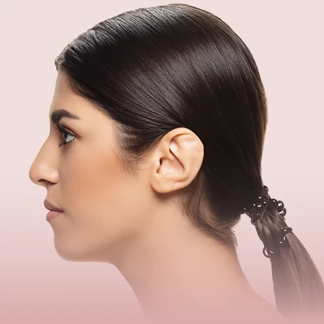 prominent ear correction