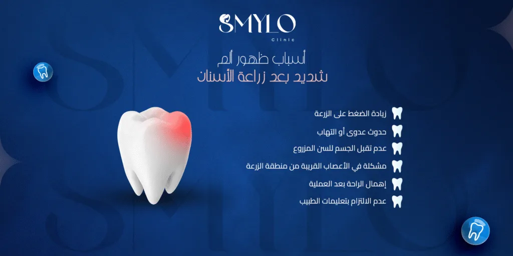 أسباب ألم الأسنان بعد الزراعة