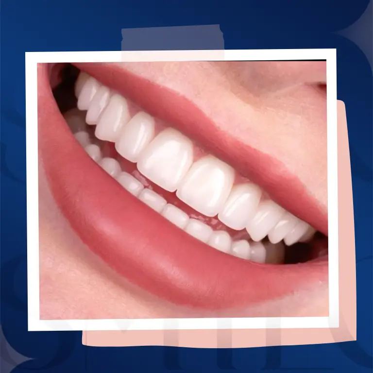 ابتسامة لامعة متوازنة