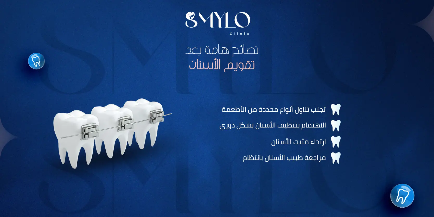 نصائح هامة بعد تقويم الأسنان