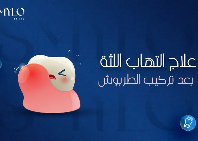 علاج التهاب اللثة بعد تركيب الطربوش