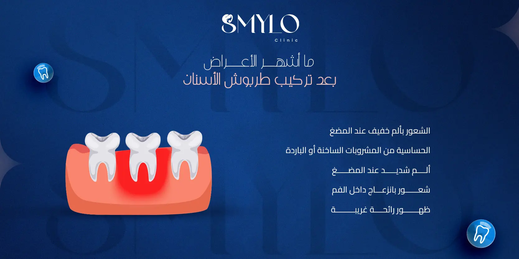 أشهر الأعراض بعد تركيب طربوش الأسنان