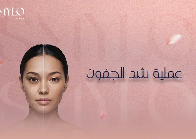 عملية شد الجفون