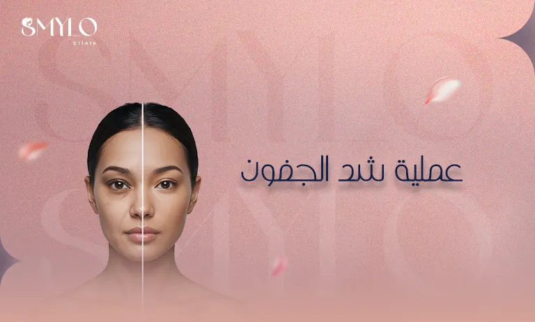 عملية شد الجفون