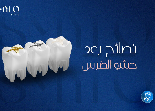 نصائح بعد حشو الضرس