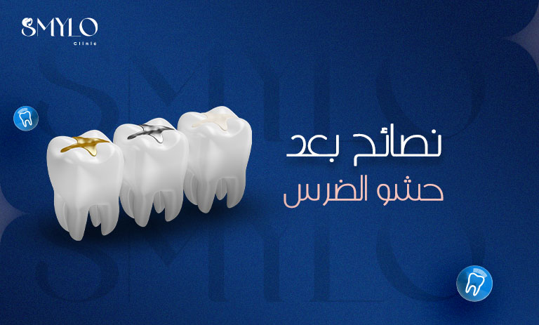 نصائح بعد حشو الضرس